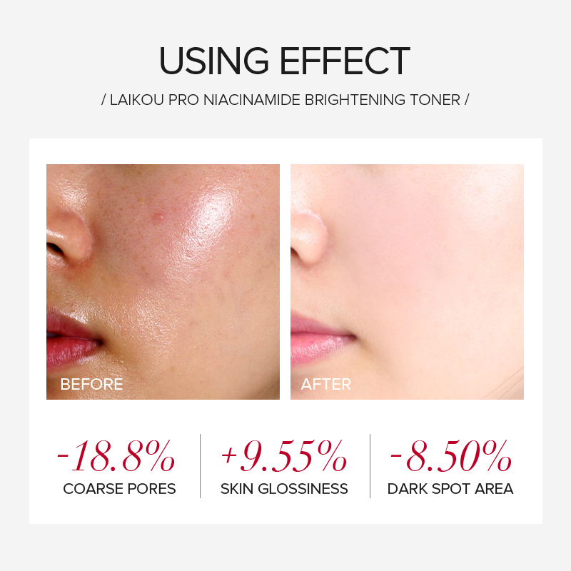 LAIKOU PRO Niacinamide 4Pcs Br - огляд і ціна Korean Skincare Routine