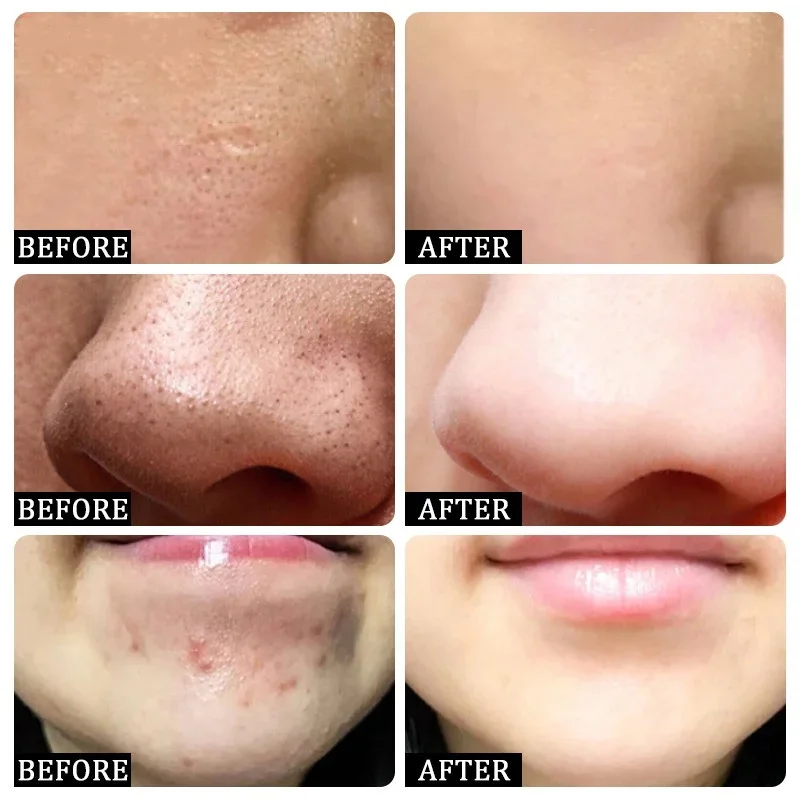 Salicylic Acid Pore Clearing C - огляд і ціна Korean Skincare Routine