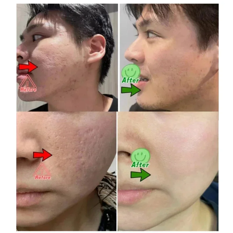 Salicylic Acid Pore Clearing C - огляд і ціна Korean Skincare Routine