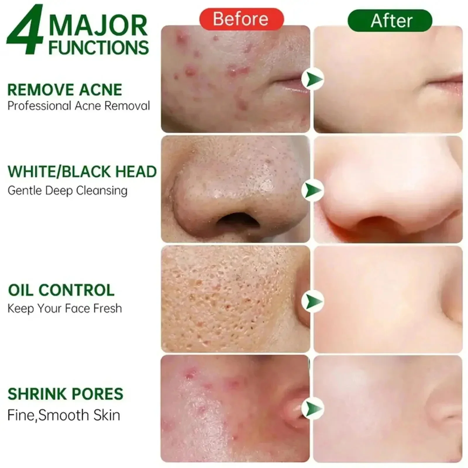 Salicylic Acid Pore Clearing C - огляд і ціна Korean Skincare Routine