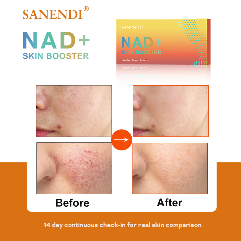 Sanendi NAD+ Korea Skincare Pr - огляд і ціна Korean Skincare Routine